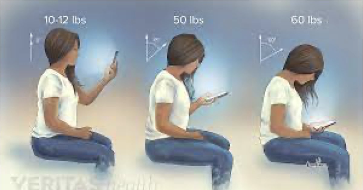 smart phone neck pain buffalo