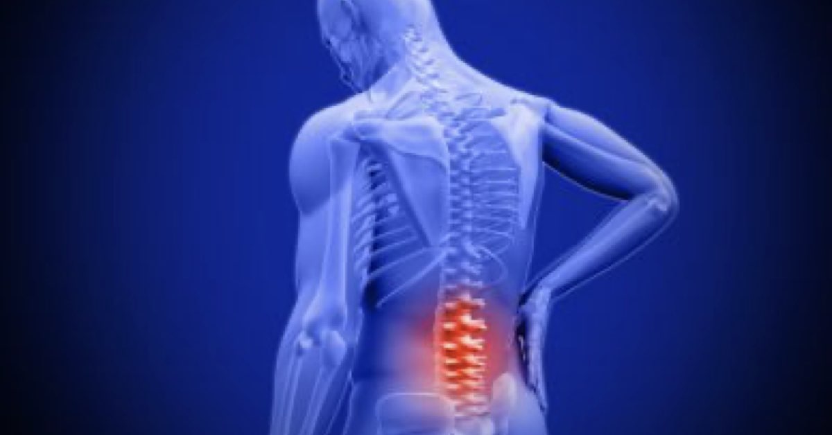 Misconceptions About the Treatment of Low Back Pain