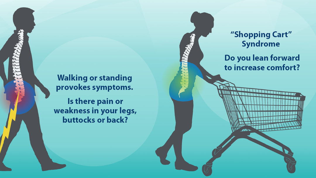 Physical Therapy for Spinal Stenosis Series (Part 2)