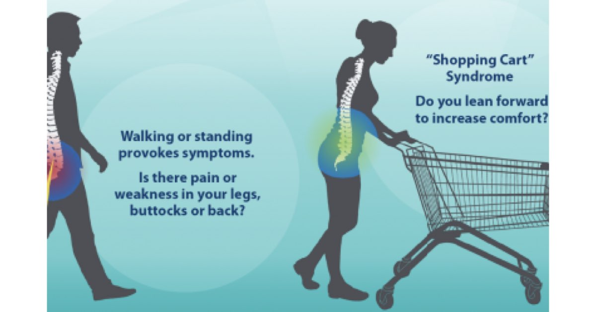 Physical Therapy for Spinal Stenosis Series (Part 2)