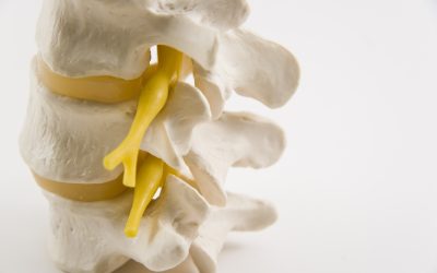 Physical Therapy for Spinal Stenosis Series (Part 5)