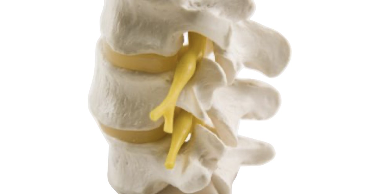 Physical Therapy for Spinal Stenosis Series (Part 5)