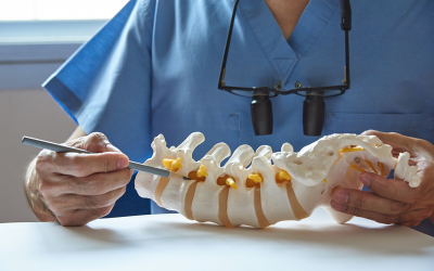 Physical Therapy for Disc Herniations Series (Part 4)