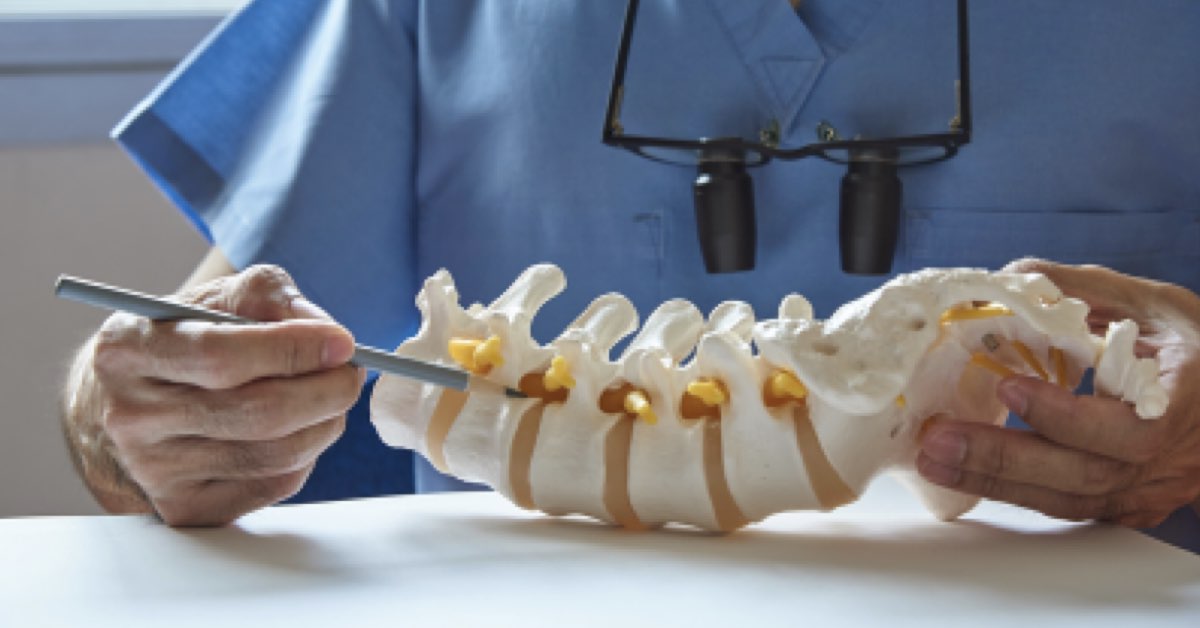 Physical Therapy for Disc Herniations Series (Part 5)