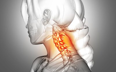 What Tests are Needed to Diagnose a Pinched Nerve in the Neck?