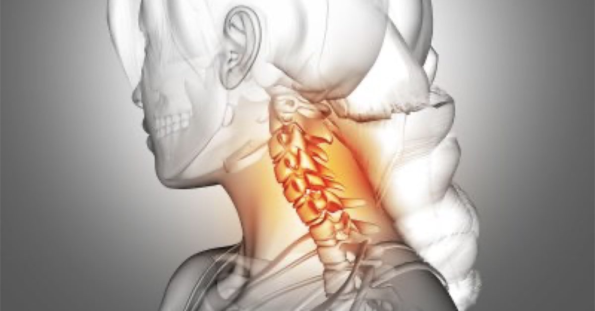 What Tests are Needed to Diagnose a Pinched Nerve in the Neck?