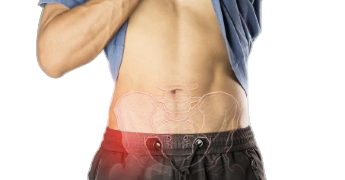 SI joint pain | Back PT Buffalo