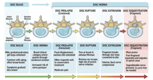 Back Pain Causes